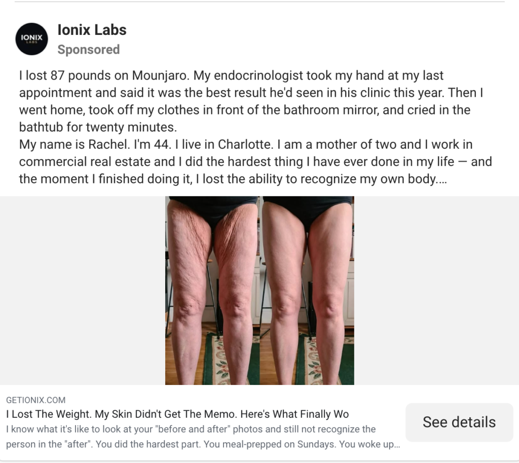 weight loss transformation
Mounjaro weight loss
GLP-1 medication
medical weight loss
weight loss testimonial
before and after legs
loose skin after weight loss
body transformation
obesity treatment
patient success story