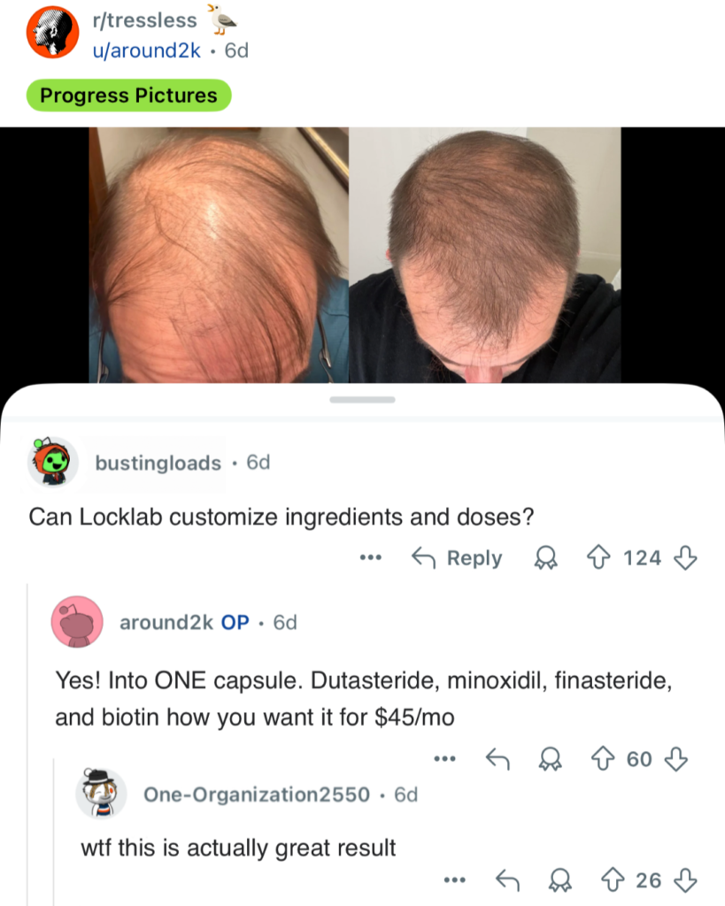 hair regrowth, hair loss treatment, before and after hair growth, thinning hair, male pattern hair loss, hair restoration results, scalp coverage, hair growth progress, baldness treatment, hair regrowth progress, thinning crown